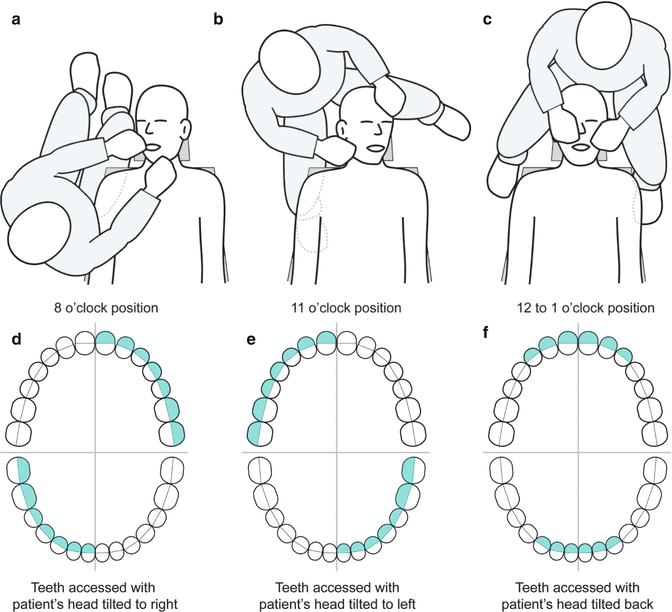 Patient Examination and Assessment Pocket Dentistry