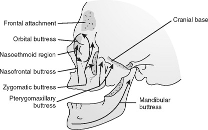 DIAGNOSTIC IMAGING OF FACIAL INJURIES | Pocket Dentistry