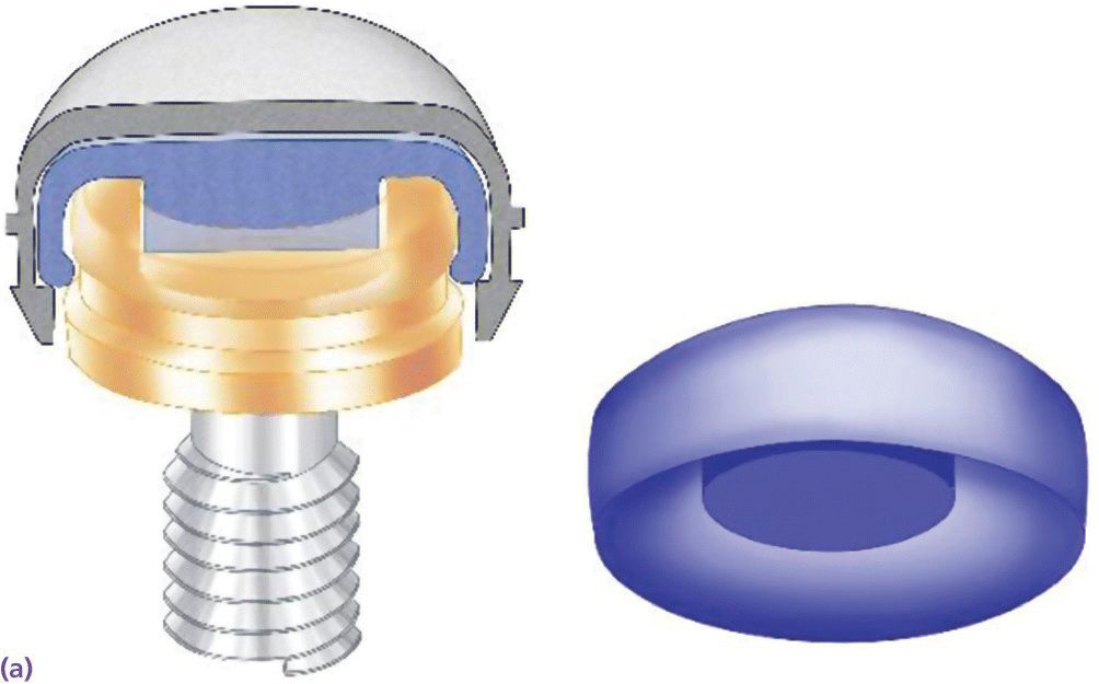 Schematic displaying nylon attachment inside metal housing engaging the internal well of Locator abutment.