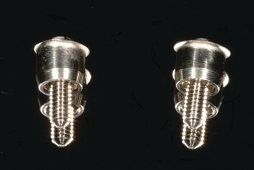 Photo of standard abutments removed after 10 years of functioning beneath a fixed dental prosthesis with cantilevered design displaying two abutments.