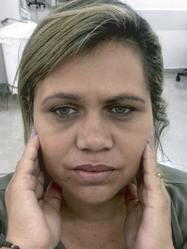 En-face photo of patient.