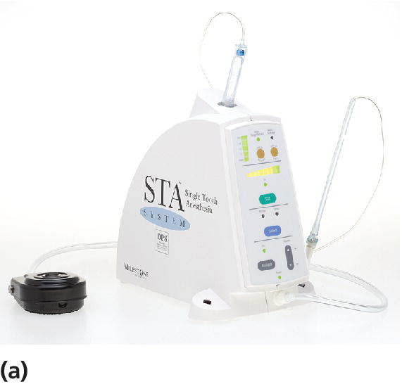 Photo of a STA™ System.