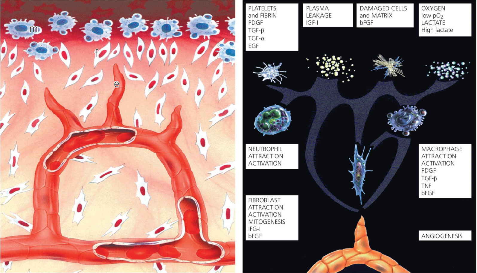 2 Illustrations displaying later wound healing events consisting of macrophages, endothelial cells, fibroblasts (left) and angiogenesis, platelets and fibrin, plasma leakage, etc. (right).