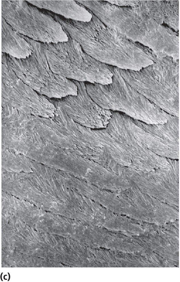 Scanning electron microscopy of surface cut etched with 30% phosphoric acid for 30 s with the border between normal and hypomineralized enamel.