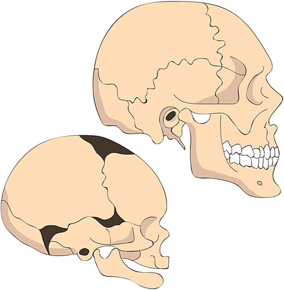 Illustration of the changes in proportions of the human head. It features an infant skull (bottom left) and an adult skull (top right).