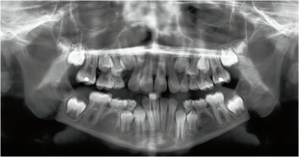3. Selection of radiographic examinations | Pocket Dentistry