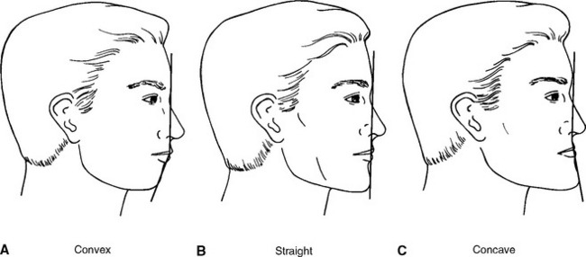 facial-profile-analysis-free-cum-fiesta