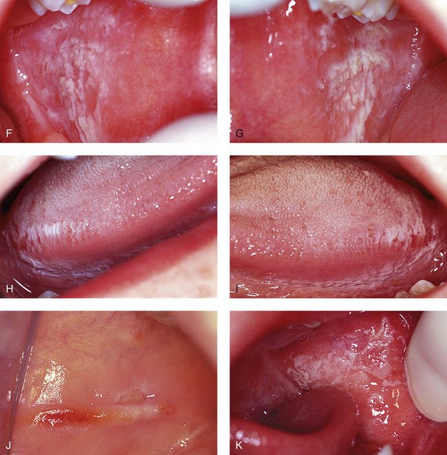 Differential Diagnosis Of Oral Lesions 47