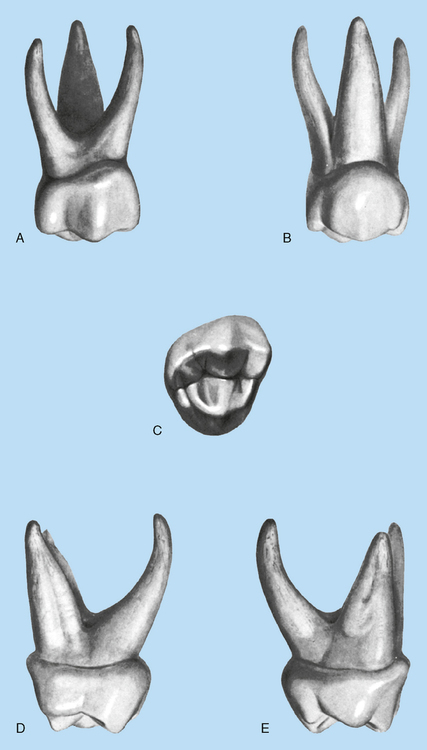 16: Deciduous Dentition | Pocket Dentistry