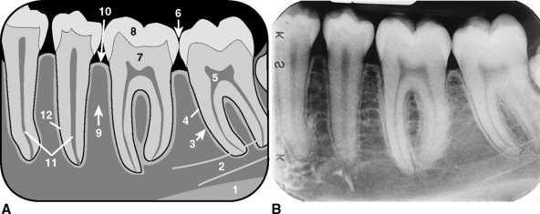 Normal Anatomy Pocket Dentistry