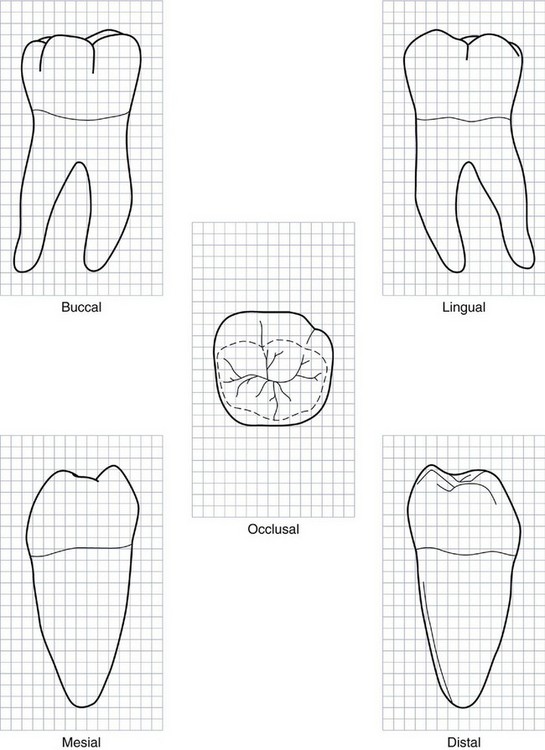 12 The Permanent Mandibular Molars Pocket Dentistry