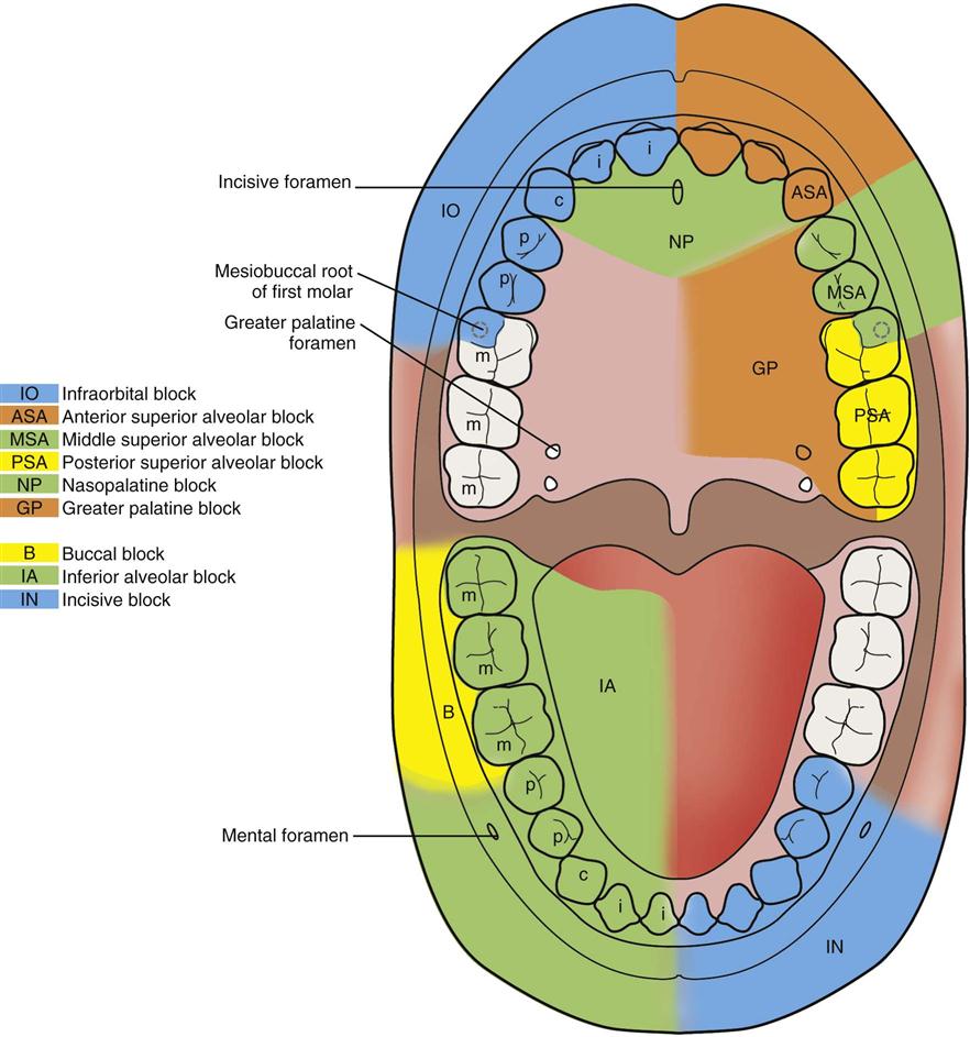 Dental Nerve Block Side Effects at Cecil Simpson blog