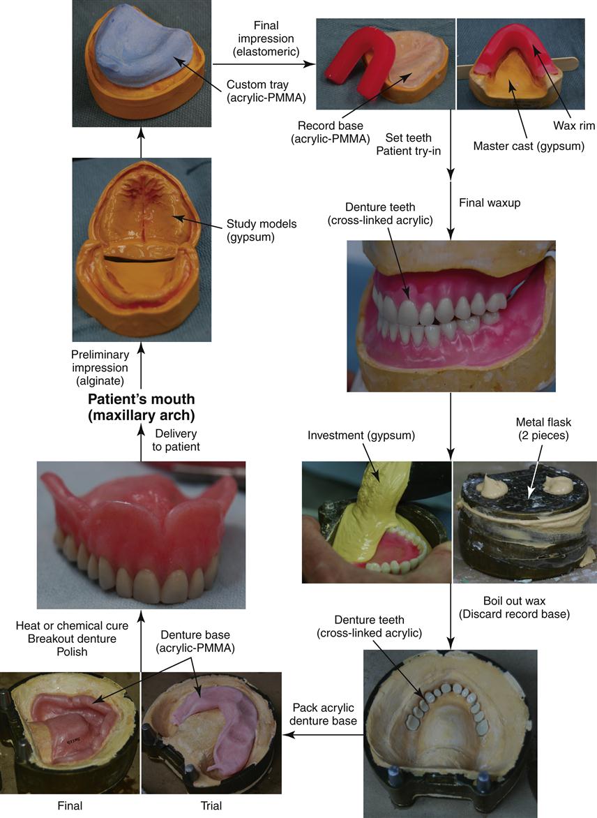 13 Polymers In Prosthodontics Pocket Dentistry