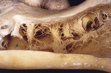 11 Bone Density | Pocket Dentistry