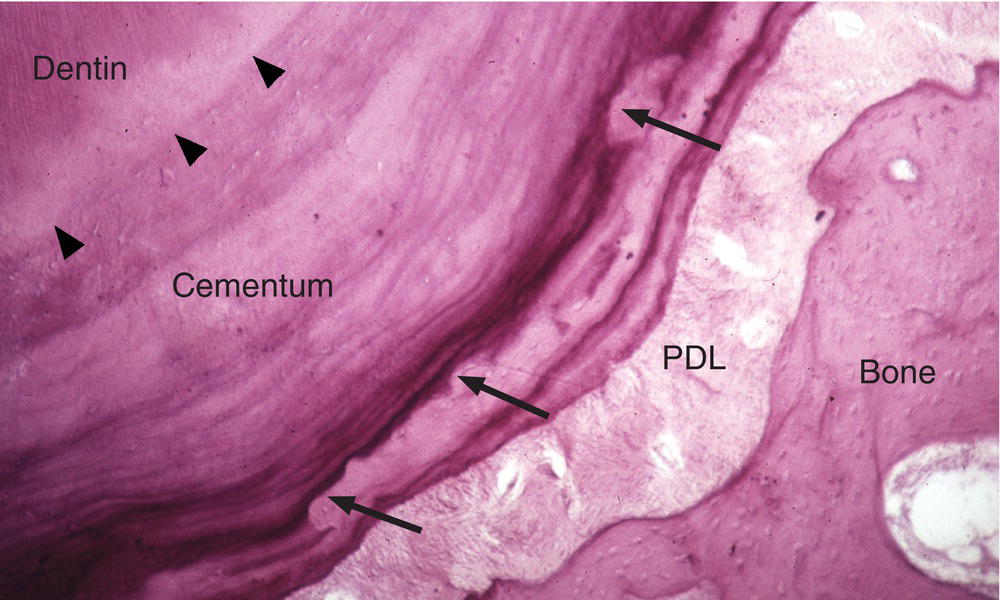 6 Structure And Physiology Of The Periodontium Pocket Dentistry