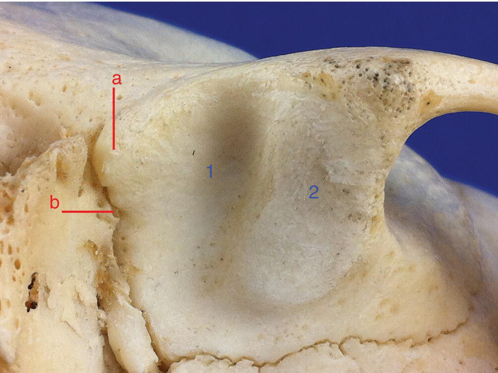 8: Temporomandibular Joint | Pocket Dentistry