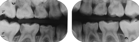 10-dental-radiography-pocket-dentistry