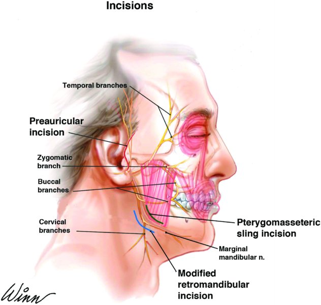 Facial Nerve Reconstruction 30