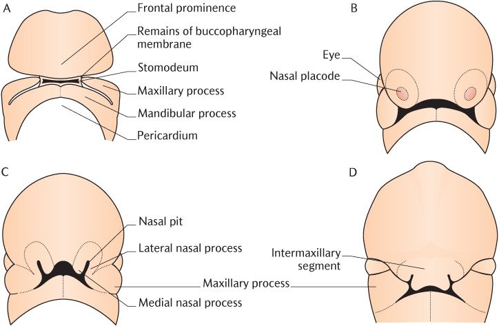 pit deep cheek Facial develops