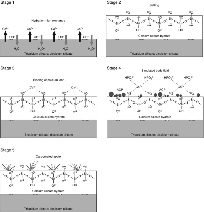 Bioactivity Of Mineral Trioxide Aggregate And Mechanism Of Action Pocket Dentistry