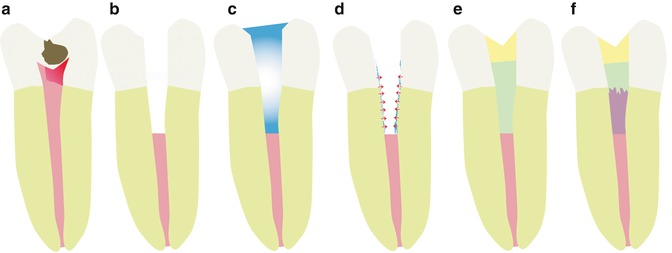 A313906_1_En_18_Fig1_HTML.jpg