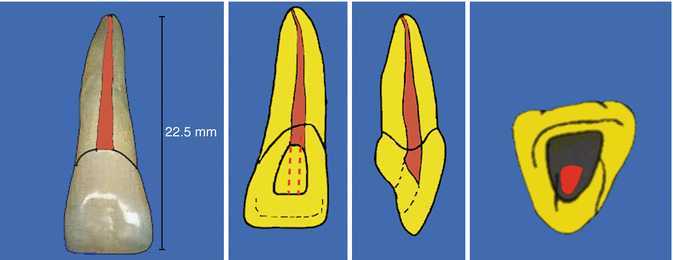thumbnail image 2 of FEN Ivorine Teeth With Root – Endodontic Dental Practice Teeth, New 2 of 2