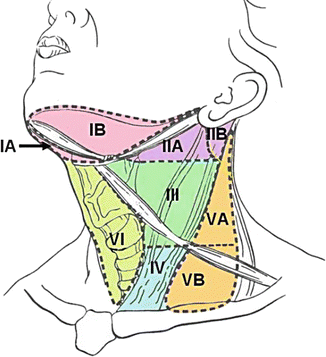 Oral Cancer: Location, Staging, Surgical Management, and Outcomes ...