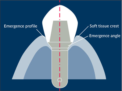 E | Pocket Dentistry