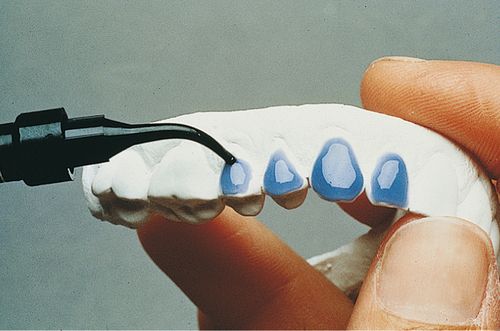 Tooth Whitening  Pocket Dentistry
