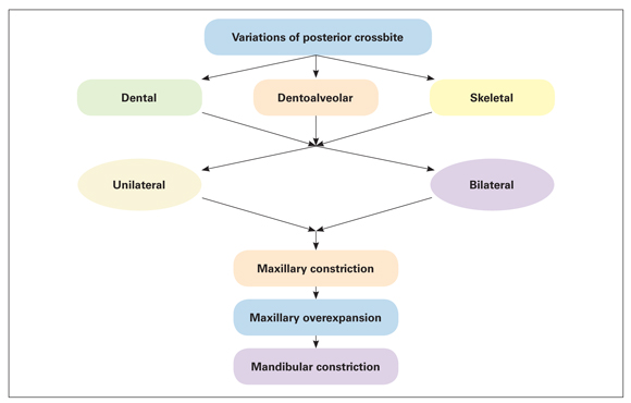 Management of Transverse Problems Posterior Crossbites Pocket