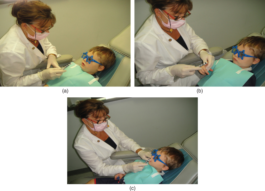 Tell Show Do Technique In Pediatric Dentistry