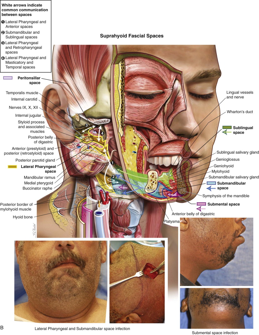 lateral pharyngeal space