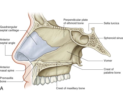 vomer fracture nasal tumor fractures articulations weakens destroys vulnerable benign