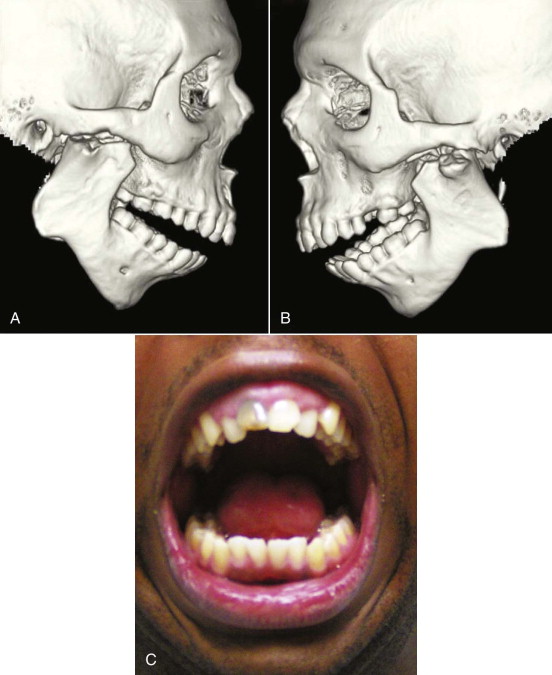 The History Of Oral And Maxillofacial Surgery | Pocket Dentistry