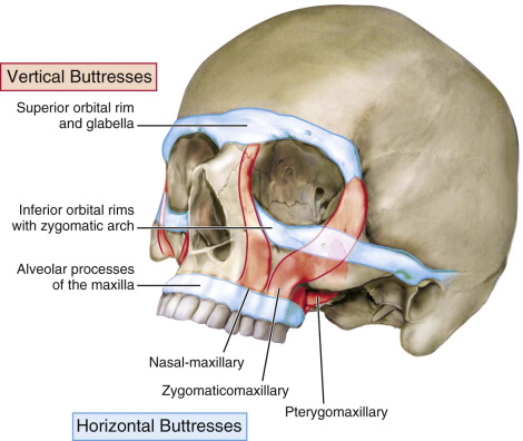 Panfacial Fractures | Pocket Dentistry
