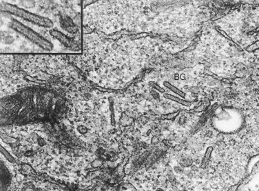 langerhans cells electron microscopy