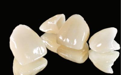 Glass ceramics clearance dental