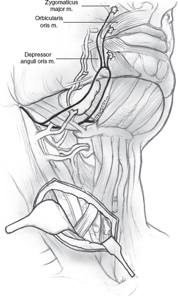 Facial Paralysis Rehabilitation Pocket Dentistry