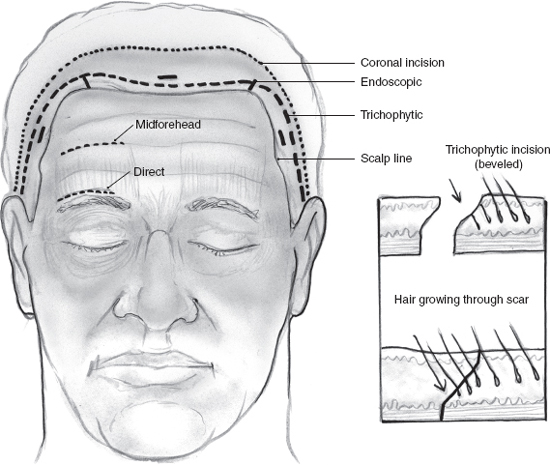 Facial Paralysis Rehabilitation