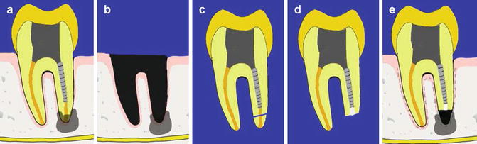 A320915_1_En_14_Fig1_HTML.jpg