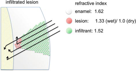 A340385_1_En_10_Fig5_HTML.jpg