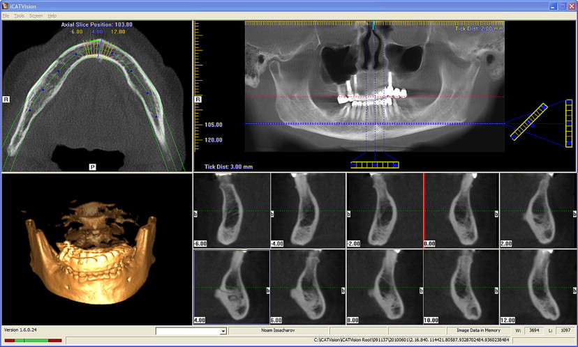 Cone Beam Computed Tomographyassisted Treatment Planning Concepts