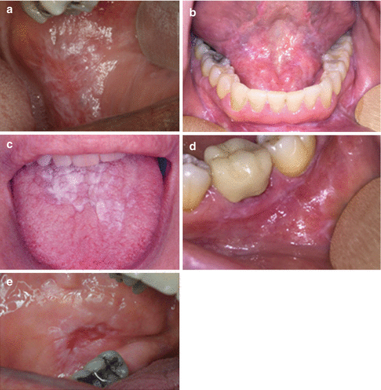 How To Describe Oral Pathology Lesions