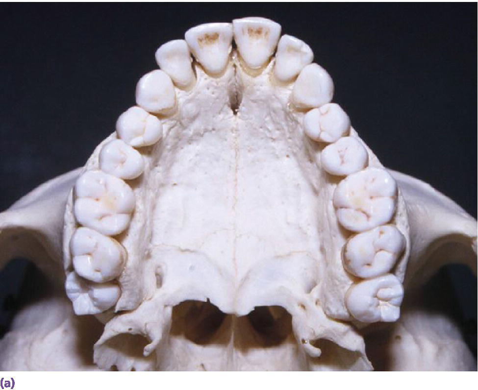 Photo displaying top view of dentate maxillae.
