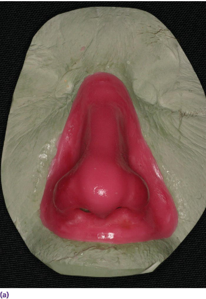 Photo displaying final wax pattern for nasal prosthesis on master cast, which contains the acrylic resin superstructure framework.