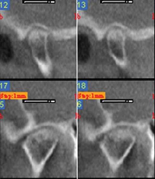 Photo showing Maximal range of motion.