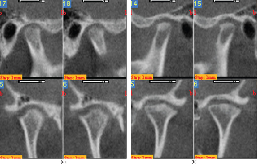 Photo showing No mandibular movements in the female. 