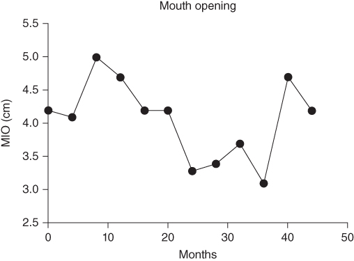 Illustration of Lateral cephalogram after resection of left TMJ ankylotic part, genioplasty and removal of eight roots.