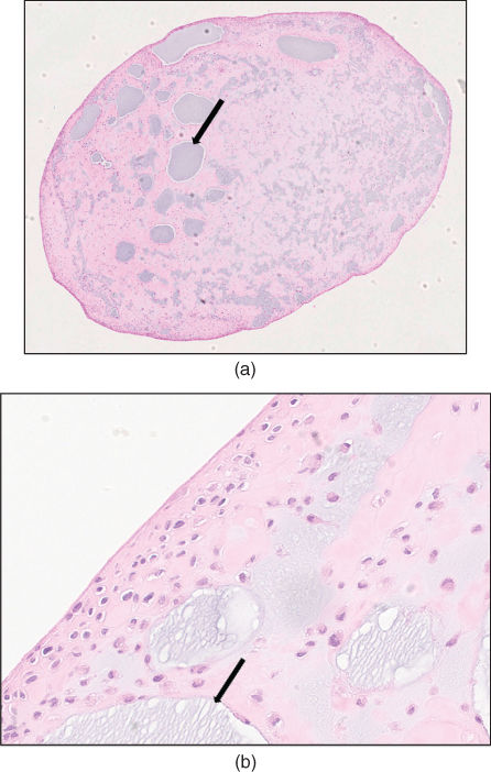 Photo showing a female opening her mouth. 