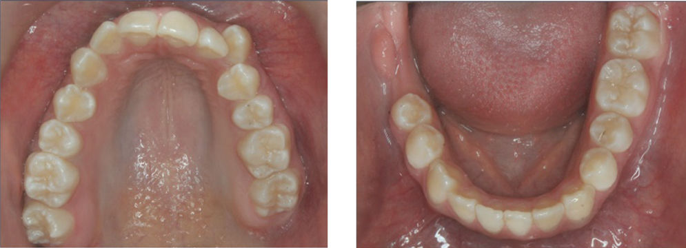 Photo showing Dental arches.